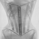 Illustration for article titled X-ray images of women in corsets show skeletons in a bind